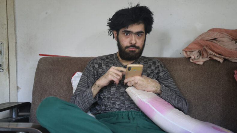 3 Yıl Süresince Duş Almadı ve Evden Dışarı Çıkmadı: Rahatsızlığı Ortaya Çıktı