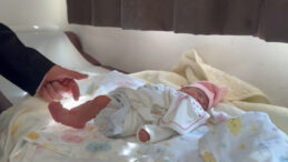 Bebeğin Eli ve Ayağı Anne Karnında Kurtarıldı