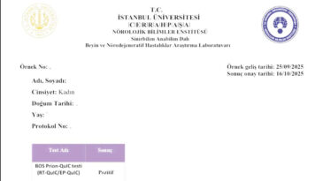 Bolu&rsquo;da Deli Dana Vakası Ortaya &Ccedil;ıktı