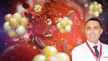 Kolesterol: Damarlarınızı Tıkamadan Önlem Alın