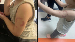 Öğretmen Kolunu Isırdı, Soruşturma Başlatıldı