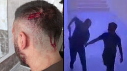 Öğretmene okulda demir sopalı saldırı: Görevi bıraktı