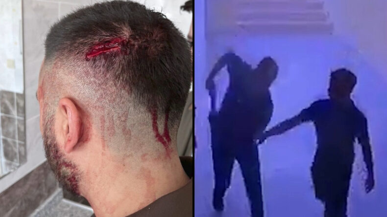 Öğretmene okulda demir sopalı saldırı: Görevi bıraktı