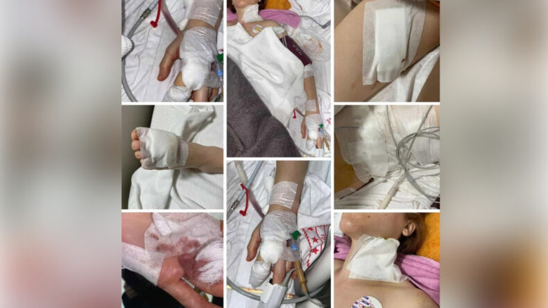 Uzaklaştırma Talebine Rağmen… Eski Eşi Tarafından 11 Yerinden Bıçaklandı