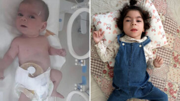 Yeni Doğan Bebekte Şiddet İddiası: Engelli Kaldı