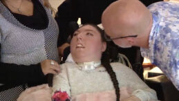 Büyük mucize: Beyni olmadan dünyaya gelmişti, şimdi 20 yaşında