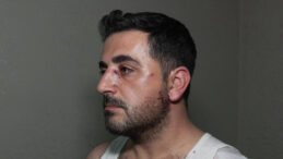 Eski Kiracı Ev Sahibine Bıçakla Saldırdı