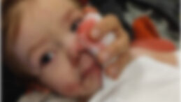 İki &ccedil;ocuk k&ouml;pek saldırısında yaralandı