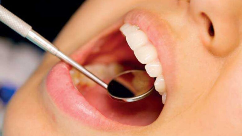 İnsan Vücudu İçin Çığır Açan Keşif: Diş Çürümesine Karşı Yeni Formül