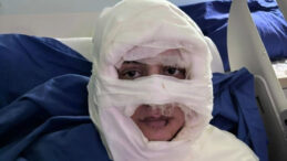 Kadıköy'de Dehşet Veren Olay: Genç Kadına Ateş Açıldı