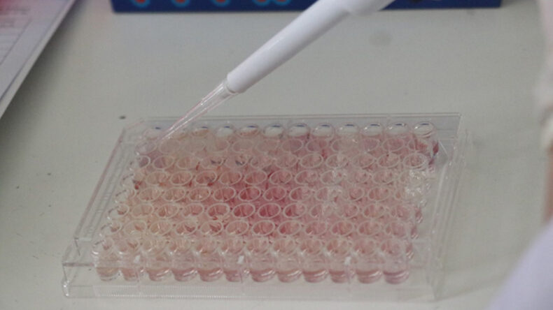 Mutluluk Hormonu ve Kanser Arasındaki Beklenmedik Bağlantı