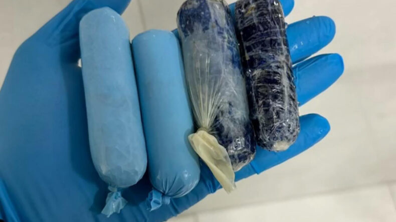 Sakladığı Uyuşturucu Muayenede Ortaya &Ccedil;ıktı