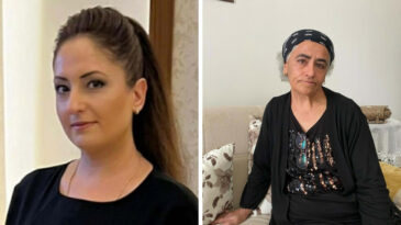 Şiddet Sonrası Hayatını Kaybetti: Sa&ccedil;ları Koparılmış