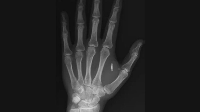 Sihirbazın K&acirc;busu: Eline Mikro&ccedil;ip Taktırdı, Şifreyi Unuttu