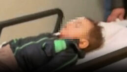 Sokakta Ateşlenen Torpil 2 Yaşındaki Alpaslan'ı K&ouml;r Etti