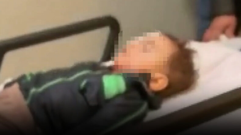 Sokakta Ateşlenen Torpil 2 Yaşındaki Alpaslan'ı K&ouml;r Etti