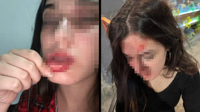 Sosyal Medyada Darp İddiası: 'Darbedildim'