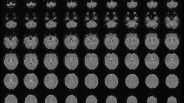 Zihin Okumada &Ccedil;ığır A&ccedil;acak Keşif: Beyindeki G&ouml;r&uuml;nt&uuml;leri C&uuml;mlelere D&ouml;n&uuml;şt&uuml;rd&uuml;ler