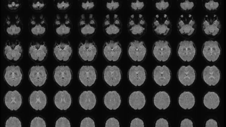 Zihin Okumada Çığır Açacak Keşif: Beyindeki Görüntüleri Cümlelere Dönüştürdüler