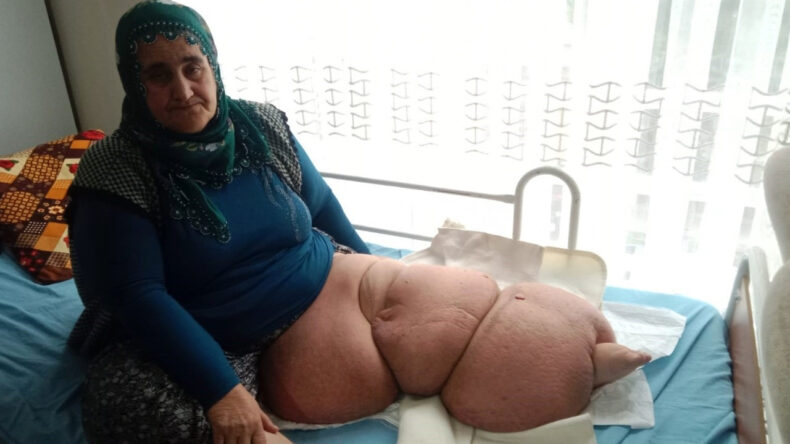 100 Kiloya Ulaştı, Yardım Bekliyor