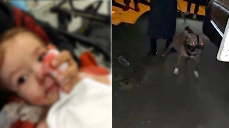 2 Kardeşe Saldıran Pitbull Daha &Ouml;nce 12 Kez Şikayet Edilmiş