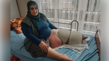 205 Kiloya Y&uuml;kseldi, Tedavisi Yarım Kaldı