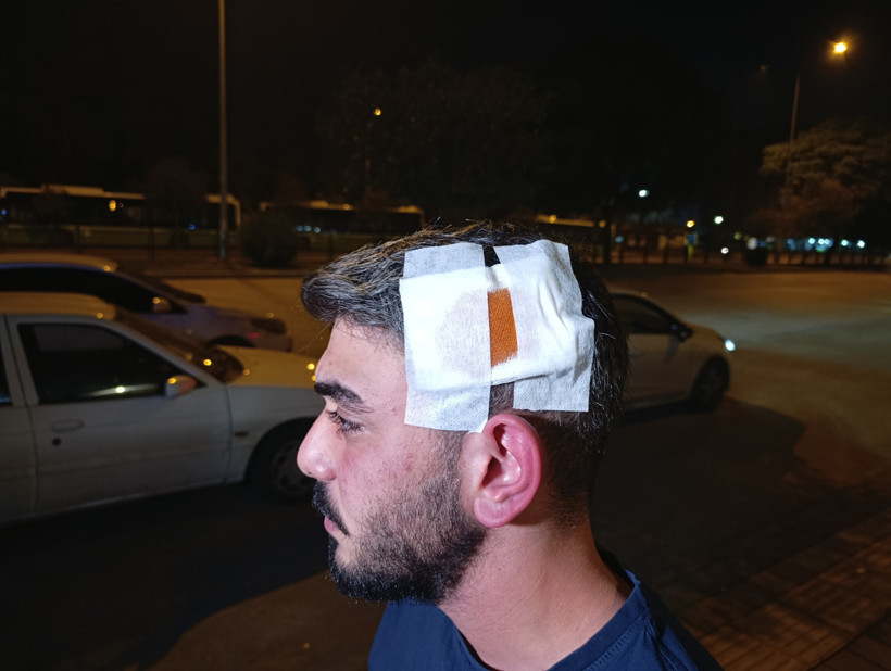 Bıçağın Kullanıldığı Yer