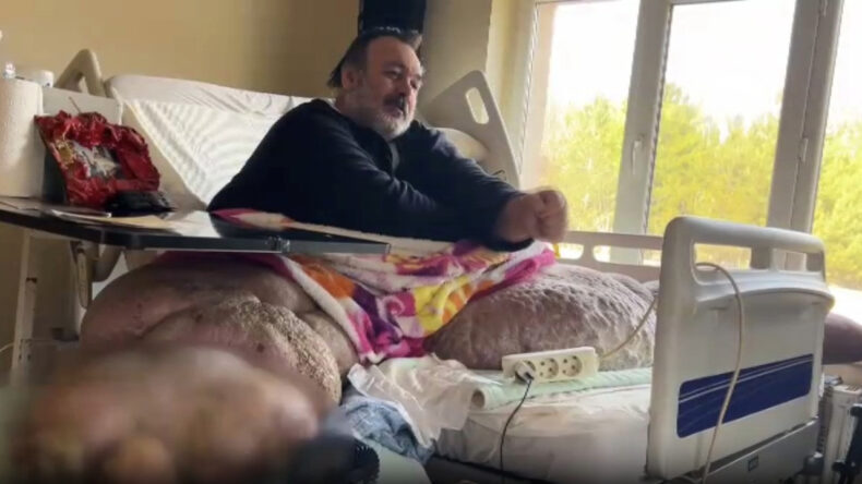 300 Kilo Oldu, 5 Yıldır Evden &Ccedil;ıkamıyor…