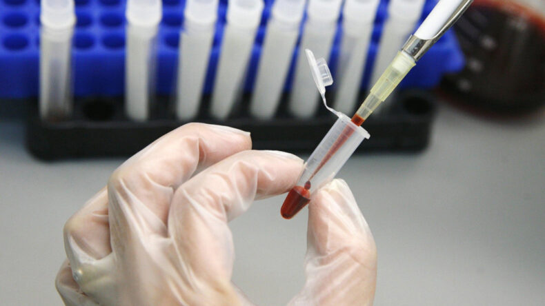 AIDS'te Korkutan Rakamlar