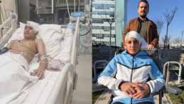 Akran Şiddeti Komalık Etti: 13 Yaşındaki &Ccedil;ocuğun Kafasını Taşla Ezdi