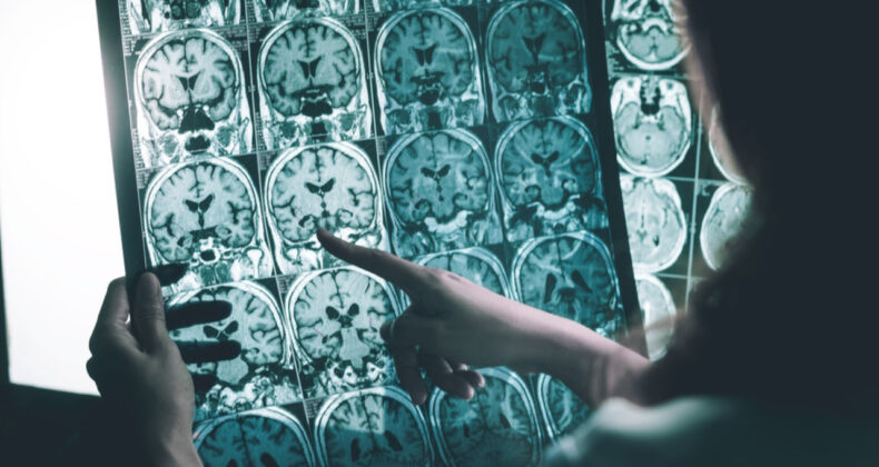 Alzheimer İla&ccedil; Gelişimi İ&ccedil;in Milyar Dolarlık Anlaşma