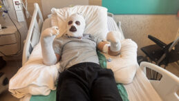 &Ccedil;ay Demlerken Patlama Yaşadı