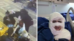 Kadık&ouml;y'de Kadına Yanıcı Madde Atan Ş&uuml;pheli İ&ccedil;in 4 Yıl 6 Ay Hapsi İstendi