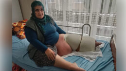 Kilosu 205 Kiloya &Ccedil;ıktı, Tedavisi Yarım Kaldı