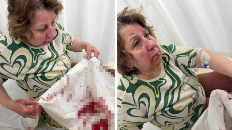 Komşusunu Darp Eden Sivil Memura Soruşturma Başlatıldı