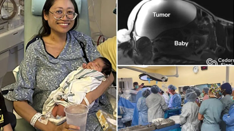 Mucizevi Doğum: Dev Kistin Altında Bebek Doğdu