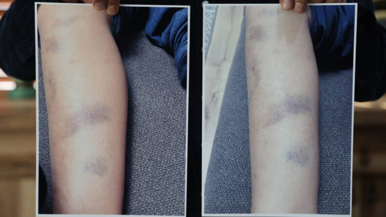 Özel okulda 8 yaşındaki çocuğa darp iddiası