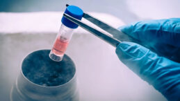 Parkinson Tedavisinde Umut Veren Gelişme: &Uuml;&ccedil; Ayda Belirgin İyileşme Sağlandı