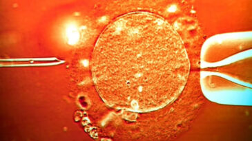 Sperm Bağışı Skandalı: Mutasyona Sahip Don&ouml;r, 197 &Ccedil;ocuğun Biyolojik Babası Oldu