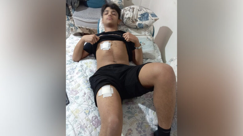 Adana'da 15 Yaşındaki &Ccedil;ocuk Akranları Tarafından D&ouml;v&uuml;l&uuml;p Bı&ccedil;aklandı