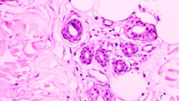 Alzheimer'lı Farelere Kanser H&uuml;creleri Enjeksiyonu: Şaşırtan Sonu&ccedil;lar