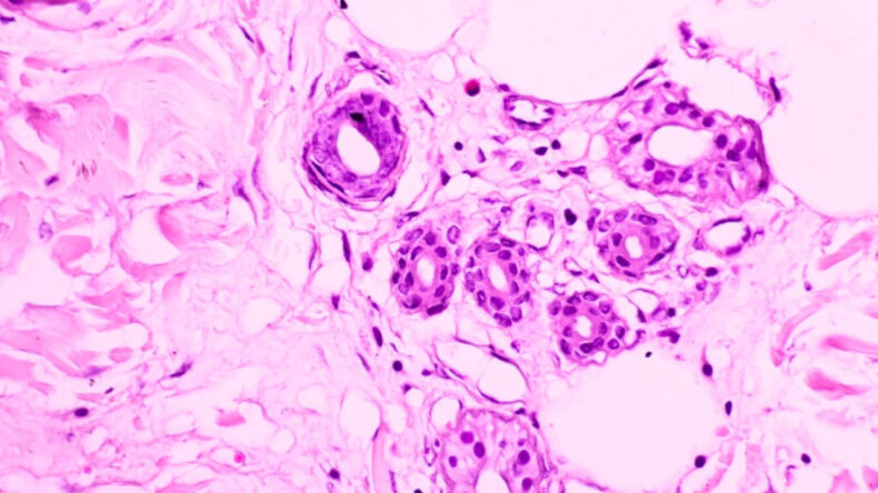 Alzheimer'lı Farelere Kanser H&uuml;creleri Enjeksiyonu: Şaşırtan Sonu&ccedil;lar