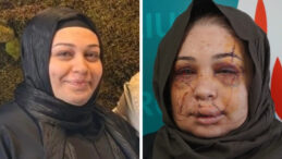 Boşanma S&uuml;recindeki Eşinin Y&uuml;z&uuml;n&uuml; Keserek G&ouml;zaltına Alınan Polis Tutuklandı