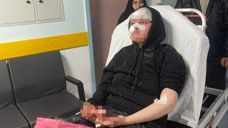 Boşanmak İsteyen Kadın Şiddetli Darbe Aldı