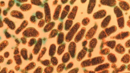 &Ccedil;arpıcı Araştırma: Sadece Kadınları Etkilemiyor