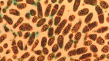 &Ccedil;arpıcı Araştırma: Sadece Kadınları Etkilemiyor