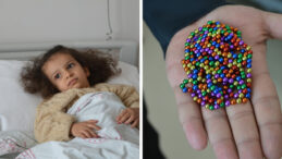 Karın Ağrısıyla Hastaneye G&ouml;t&uuml;r&uuml;len 4 Yaşındaki Eda'nın Bağırsağından 8 Mıknatıs &Ccedil;ıktı