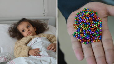 Karın Ağrısıyla Hastaneye G&ouml;t&uuml;r&uuml;len 4 Yaşındaki Eda'nın Bağırsağından 8 Mıknatıs &Ccedil;ıktı