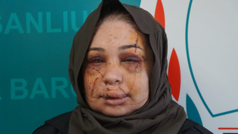 "G&uuml;zelliğini elimden alacağım" diyerek y&uuml;z&uuml;n&uuml; kesti: Serbest kaldı