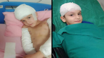 Tunahan'ı K&ouml;pekler Yaralamıştı: &Uuml;&ccedil; Kurum Tazminat &Ouml;deyecek